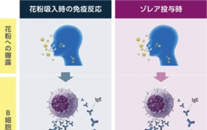 ゾレアに関するよくある質問